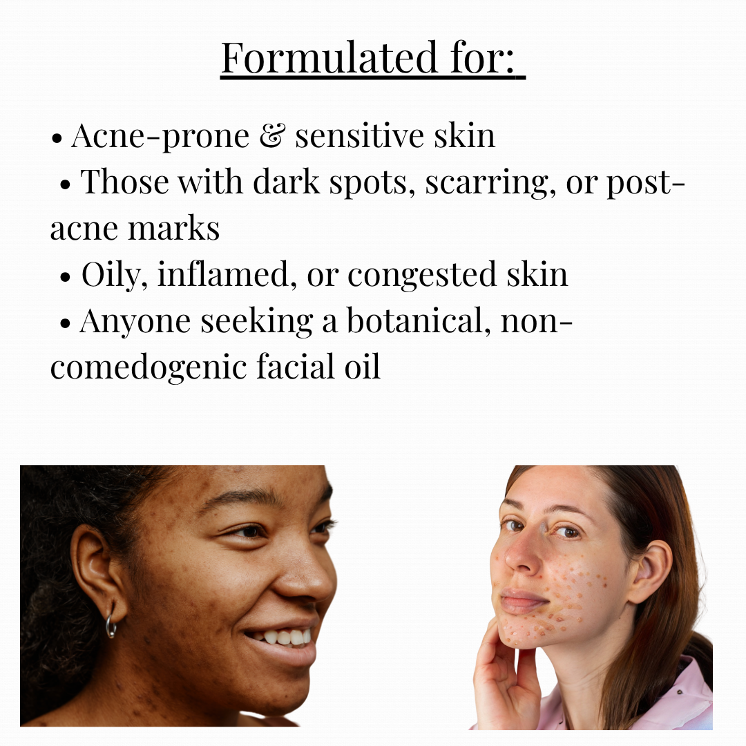Acne and Scar Treatment Oil